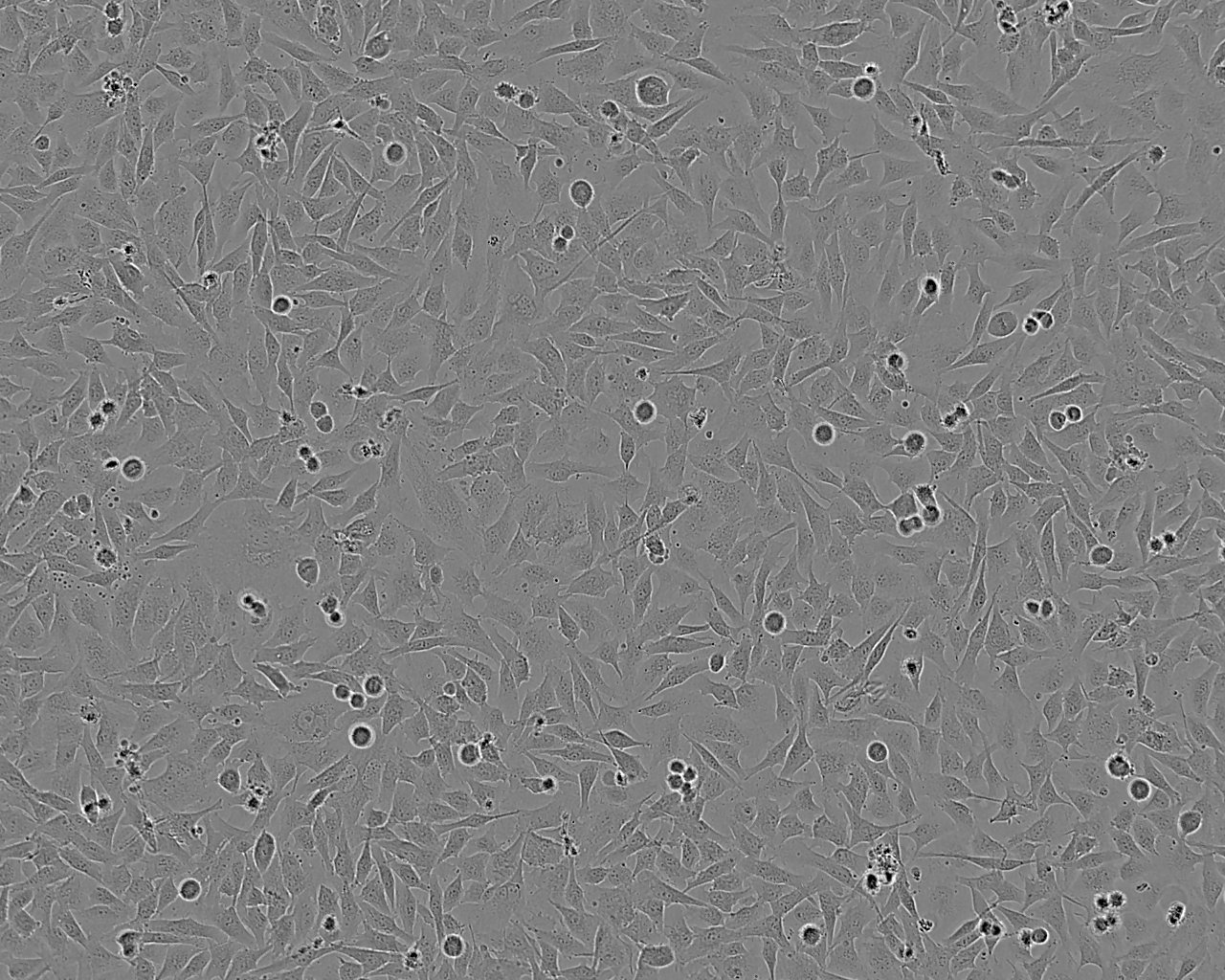 WERI-Rb-1 Cell:人视网膜母细胞瘤细胞系