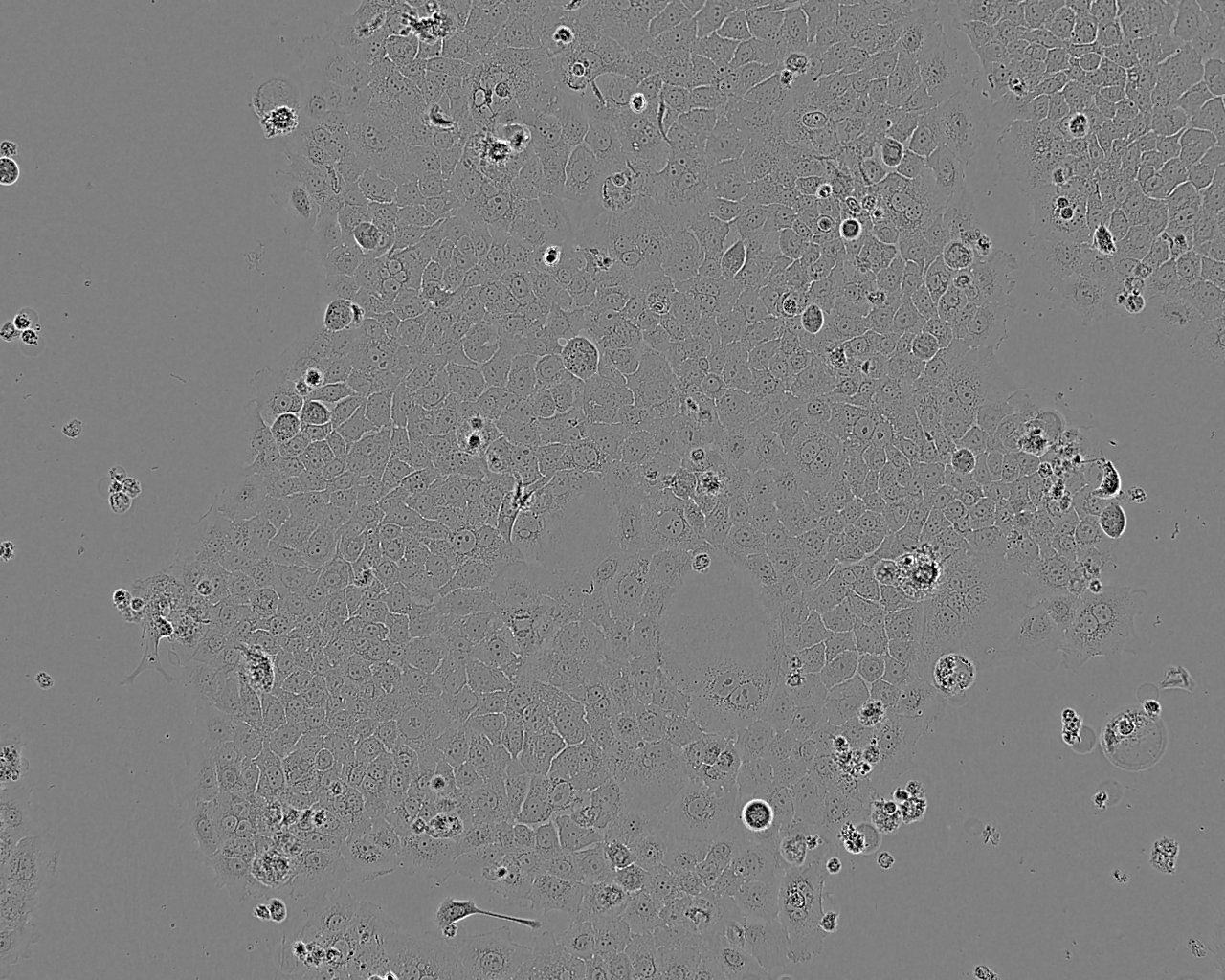 HuCC-T1 Cell:人胆管癌细胞系