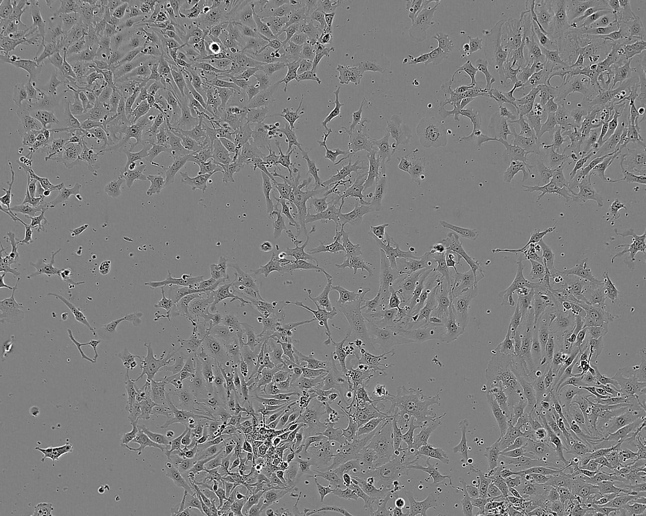 NCI-H1573 Cell:人肺癌腺癌细胞系