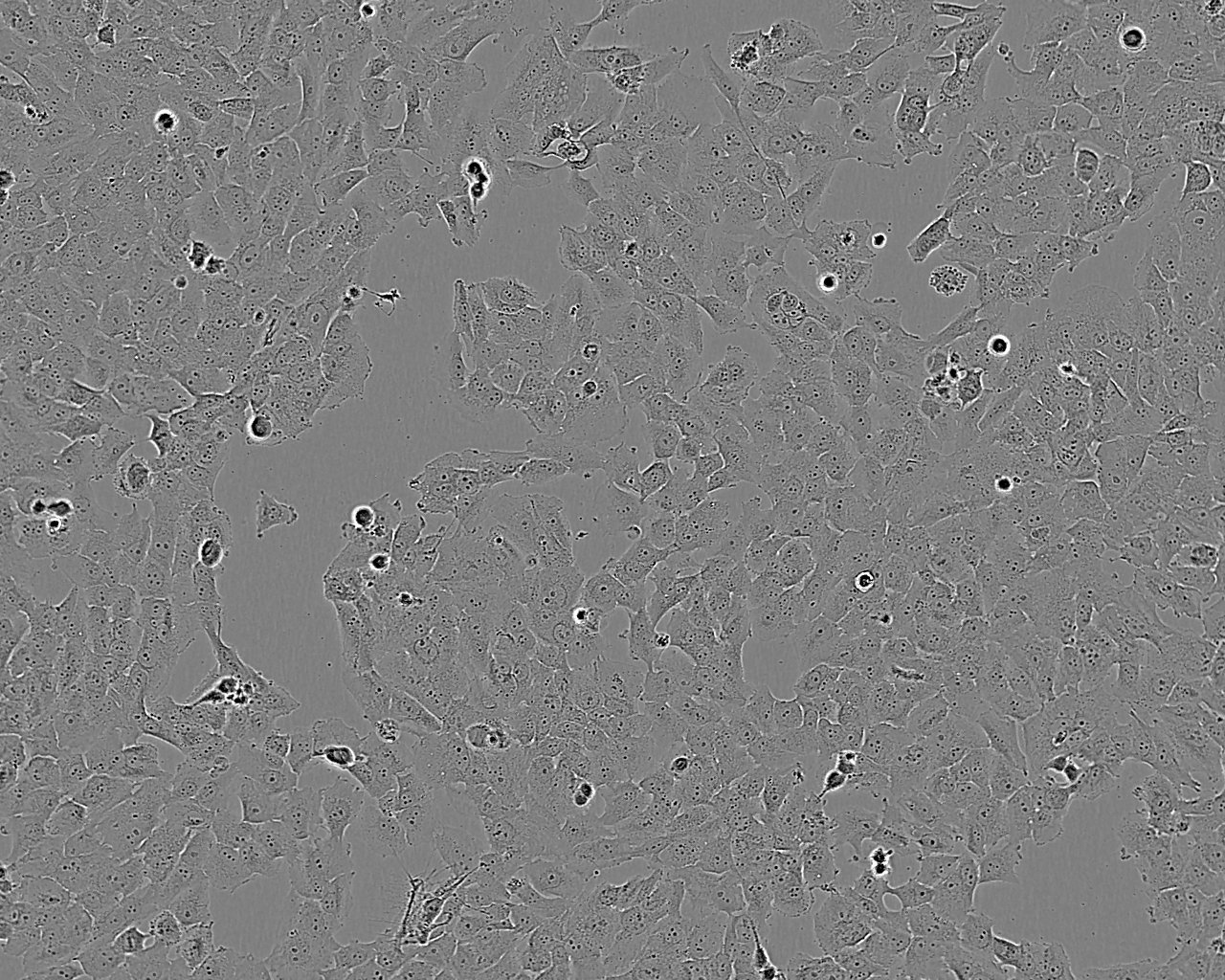 NCI-H1666 Cell:人肺支气管癌细胞系