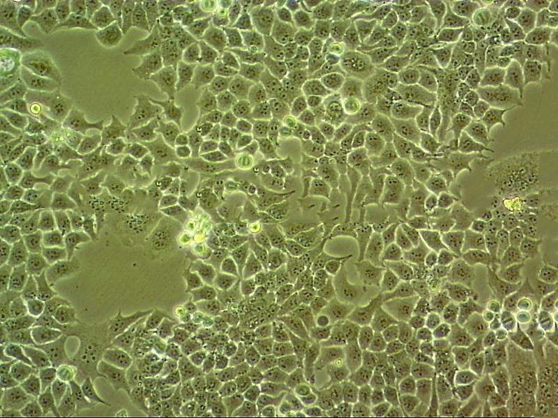 NCI-H2286 Cell:人肺癌细胞系