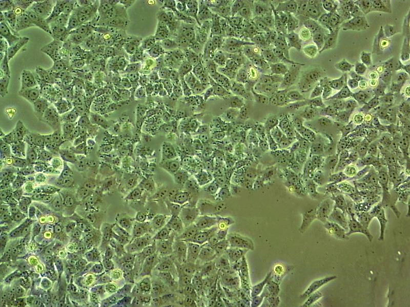 NCI-H1563 Cell:人胚肺细胞系