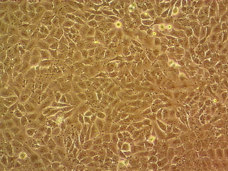 NCI-H1869 Cell:人肺癌细胞系