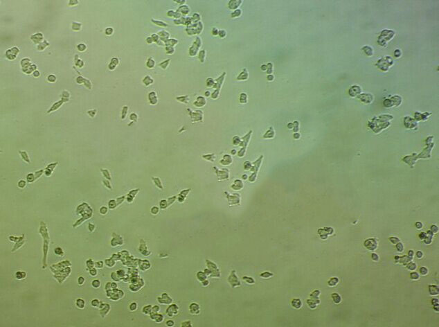 NCI-H1770 Cell:人非小细胞肺癌细胞系