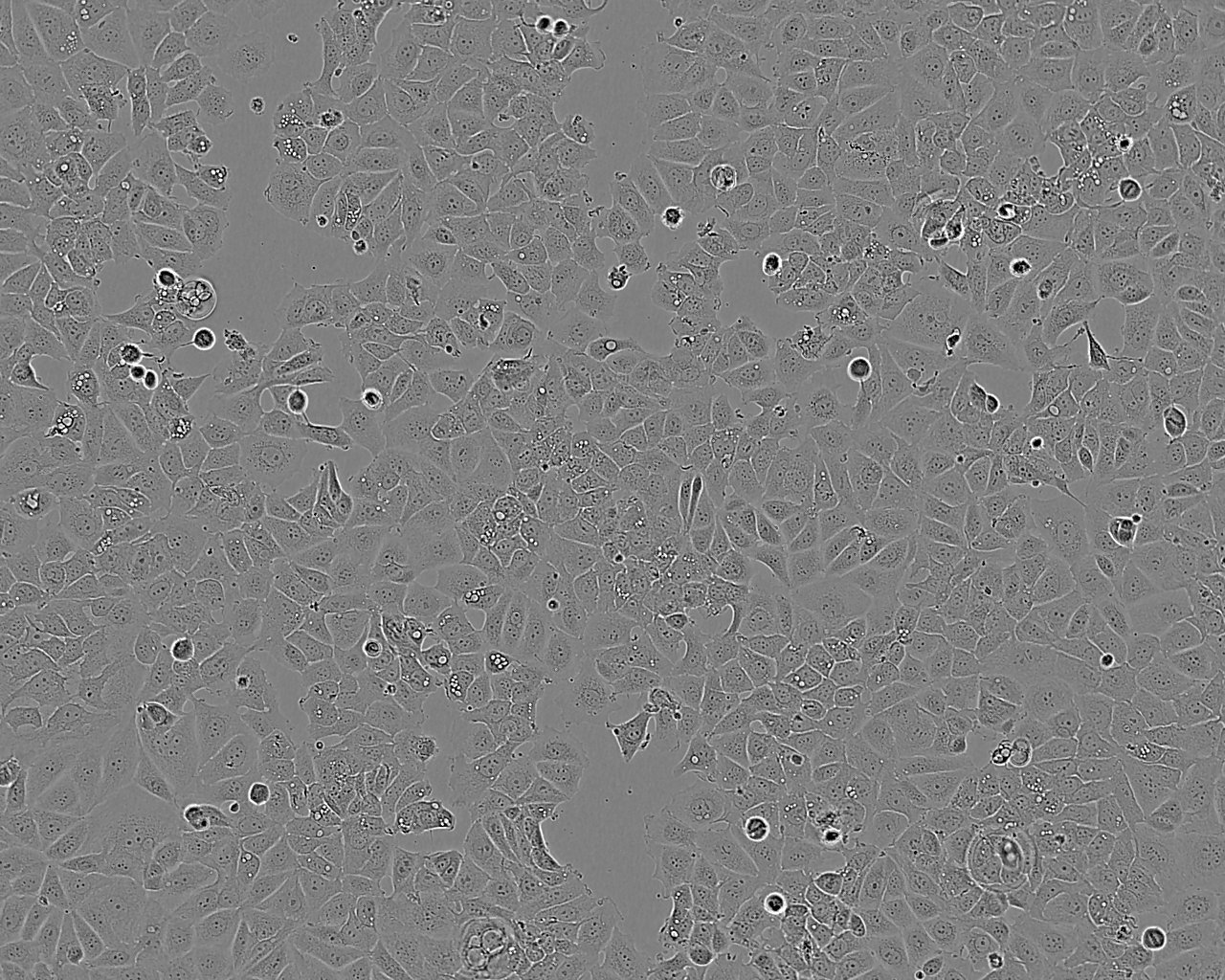 NCI-H1915 Cell:人非小细胞肺癌细胞系