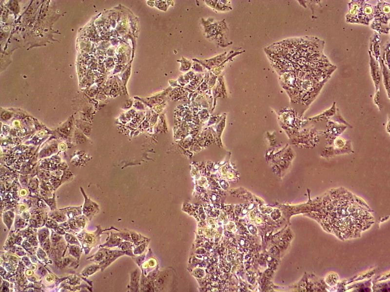 NCI-H1048 Cell:人小细胞肺癌细胞系
