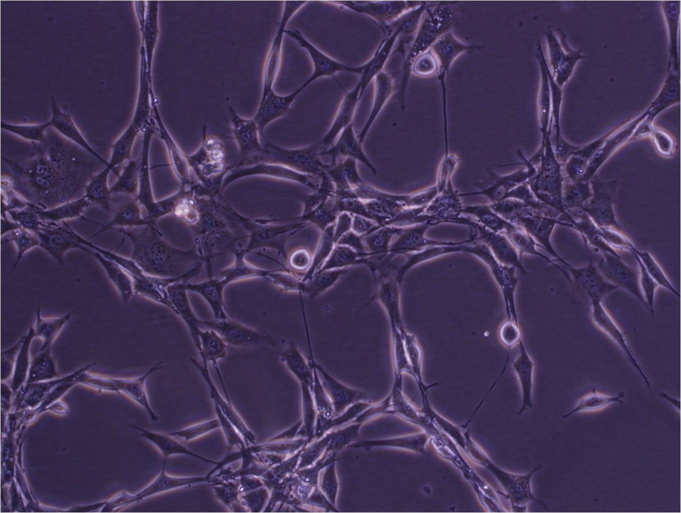 NCI-H2171 Cell:人小细胞肺癌细胞系