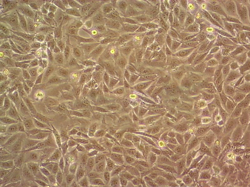 NCI-H82 Cell:人小细胞肺癌细胞系