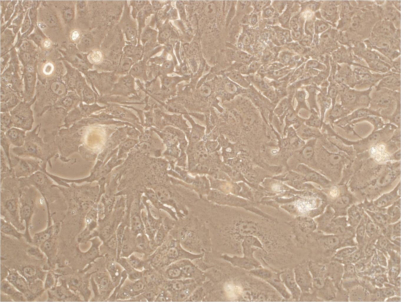 RD Cell:人恶性胚胎横纹肌瘤细胞系