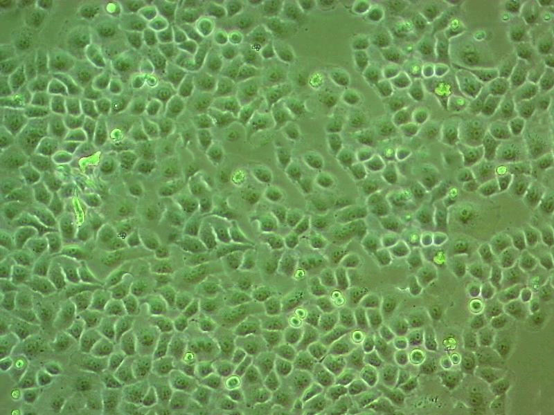 TYK-nu Cell:人卵巢癌细胞系