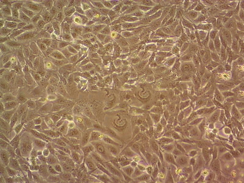 CHP-100 Cell:人成神经细胞系