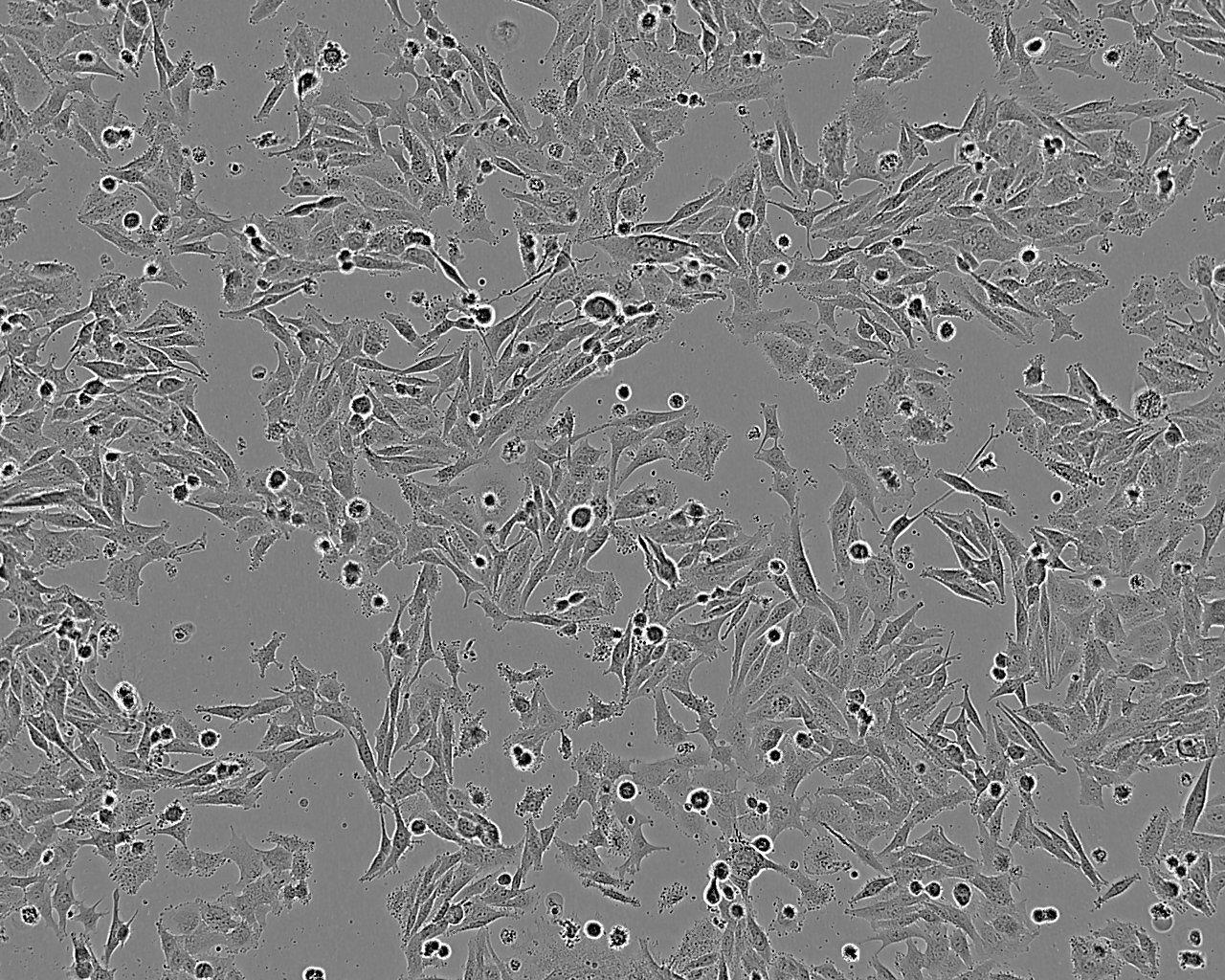SLMT-1 Cell:人食管鳞癌细胞系