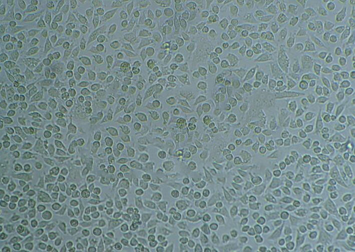 RT-112 Cell:人膀胱癌细胞系