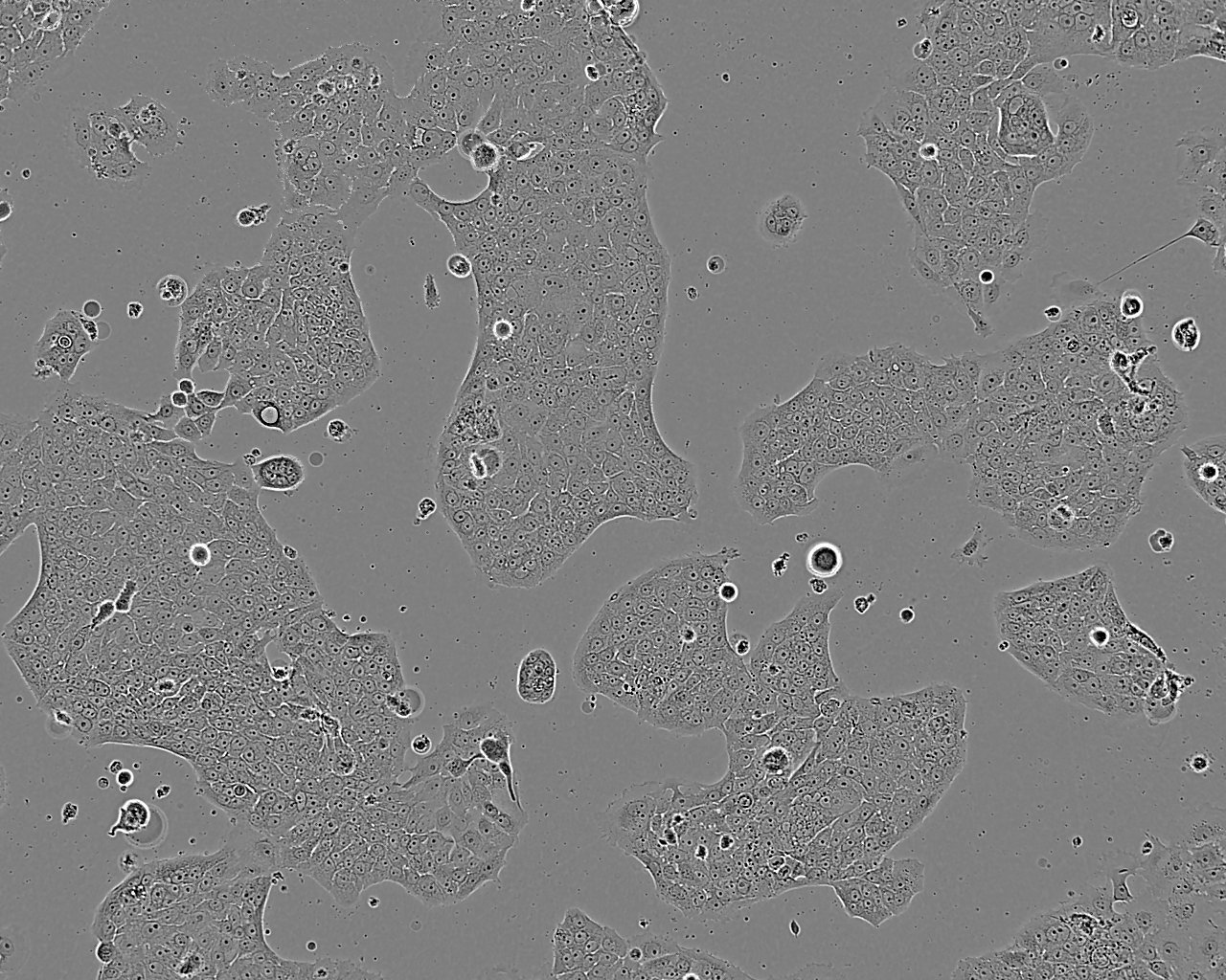 GLAG-66 Cell:人乳头状甲状腺癌细胞系