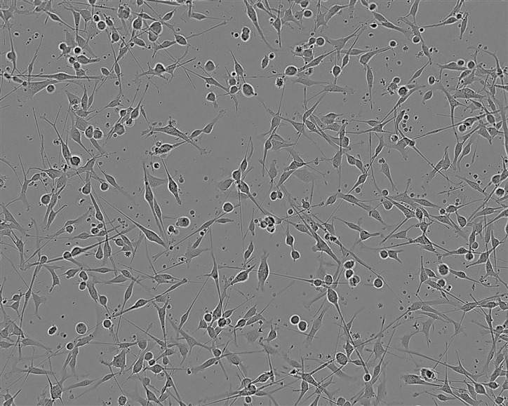 SW1271 Cell:人肺腺癌细胞系