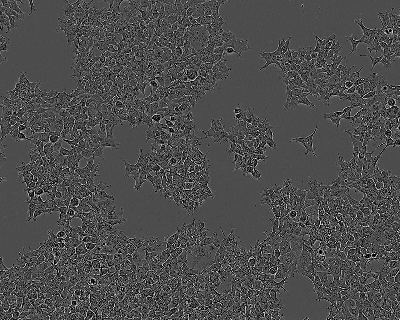 HCC94 Cell:人子宫鳞癌细胞系