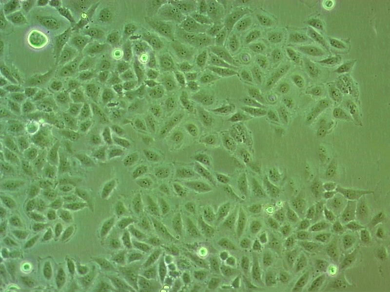 RPMI-7951 Cell:人恶性黑色素瘤细胞系