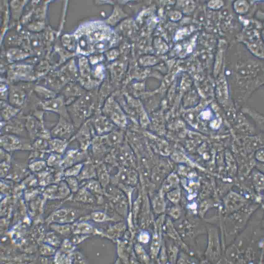 SK-MEL-28 Cell:人恶性黑色素瘤细胞系