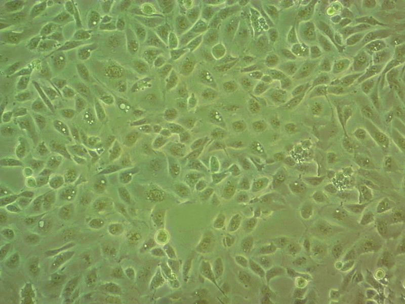 SK-MEL-5 Cell:人恶性黑色素瘤细胞系