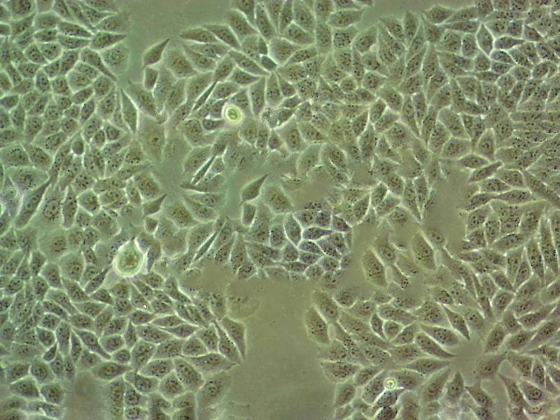 MKN1 Cell:人胃癌细胞系