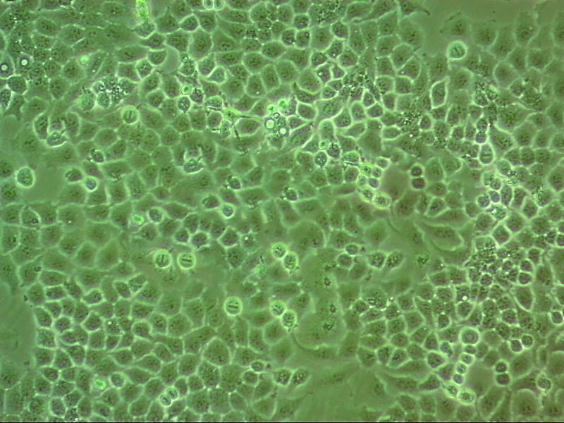 SCC-15 Cell:人鳞状细胞癌细胞系