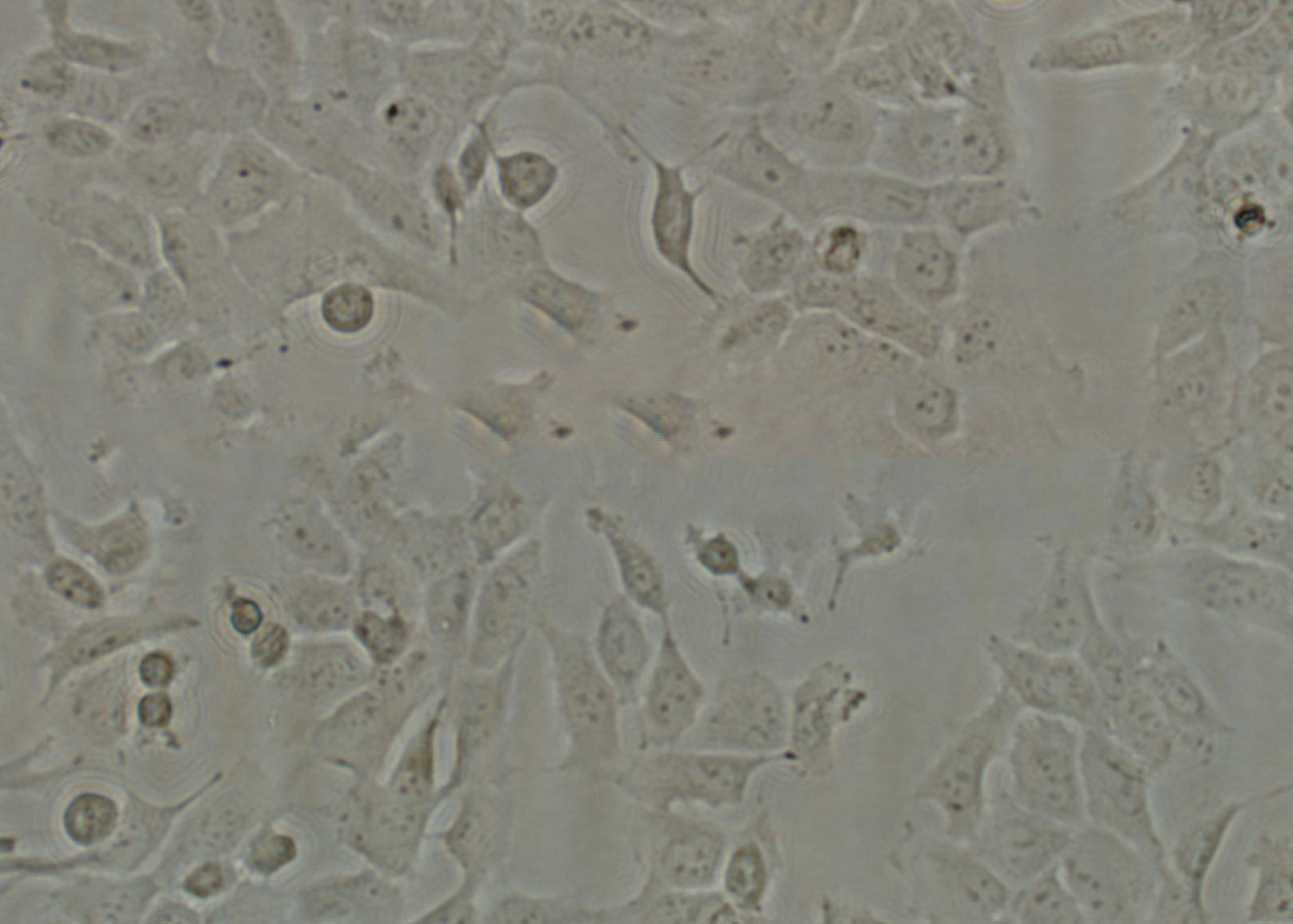 SCaBER Cell:人鳞状膀胱癌细胞系