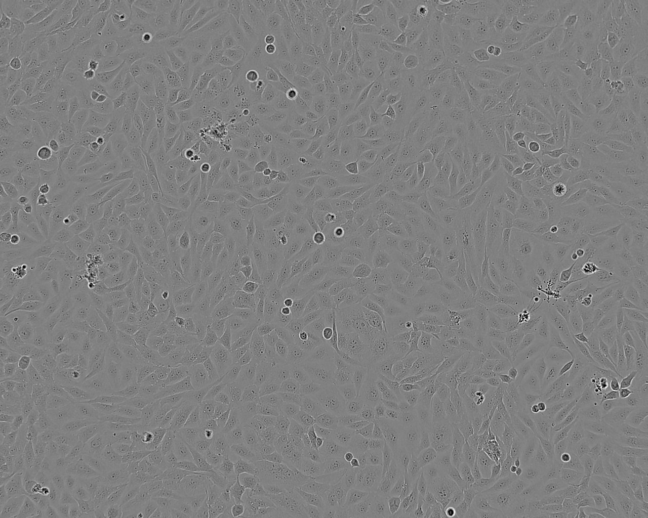 TCCSUP Cell:人膀胱移行细胞癌细胞系