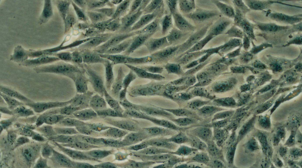 大鼠肾系膜细胞；RMC