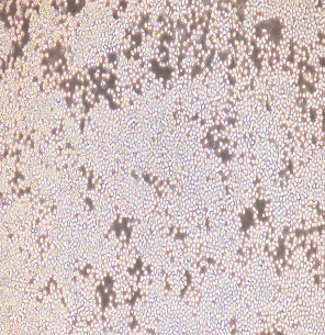 大鼠肺成纤维细胞；RL1