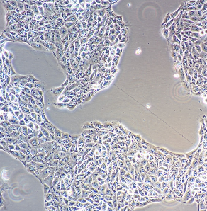 人B淋巴细胞瘤细胞