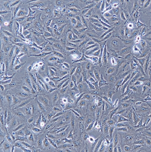 人小细胞肺癌细胞；NCI-H69