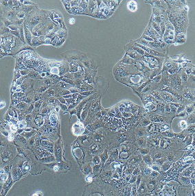人前列腺癌低转移细胞株；PC-3M-2B4