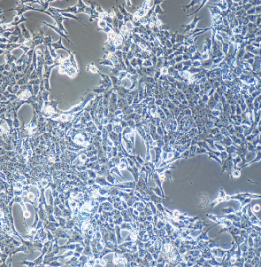 人恶性多发性畸胎瘤细胞；NTERA-2
