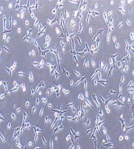 人肺腺癌细胞；NCI-H3122