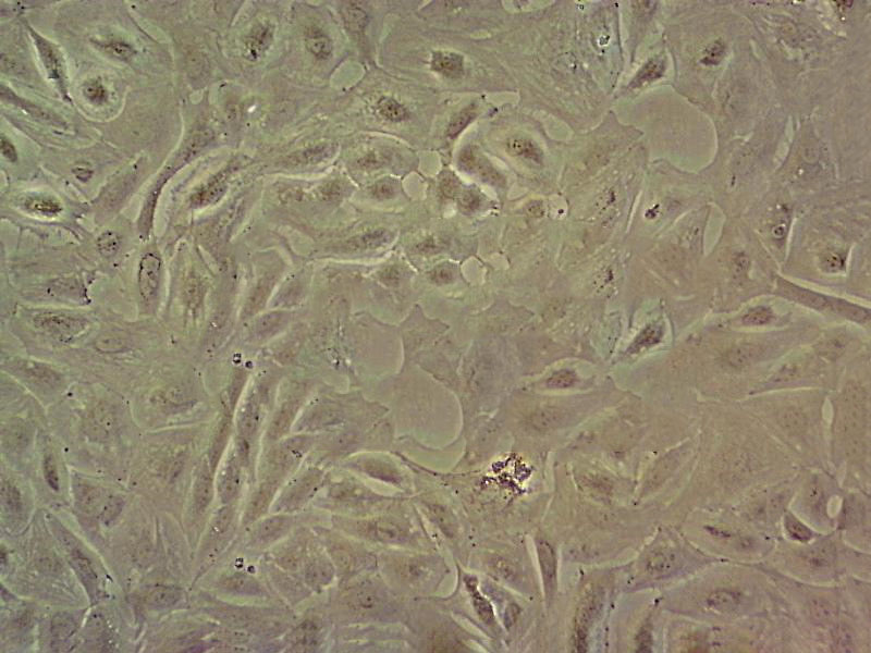 M14 Cell:人黑色素瘤细胞系