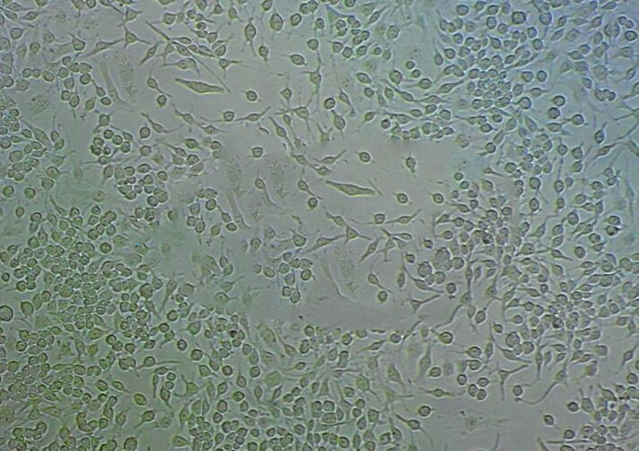 TE-9 Cell:人食管癌细胞系