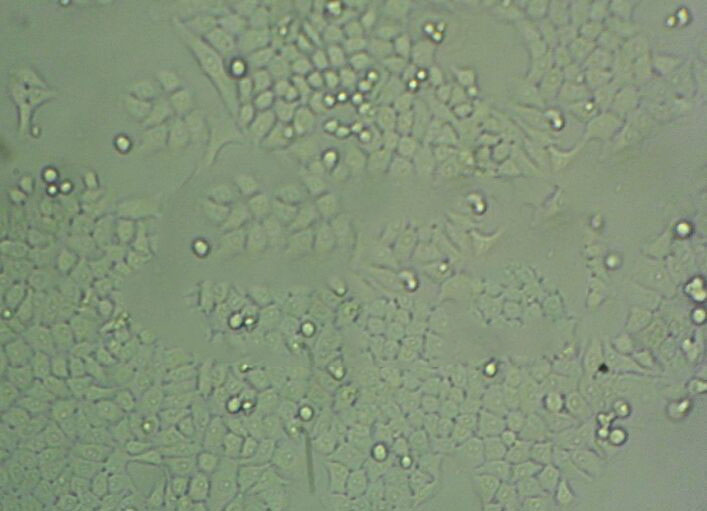 CoC1 Cell:人卵巢癌细胞系