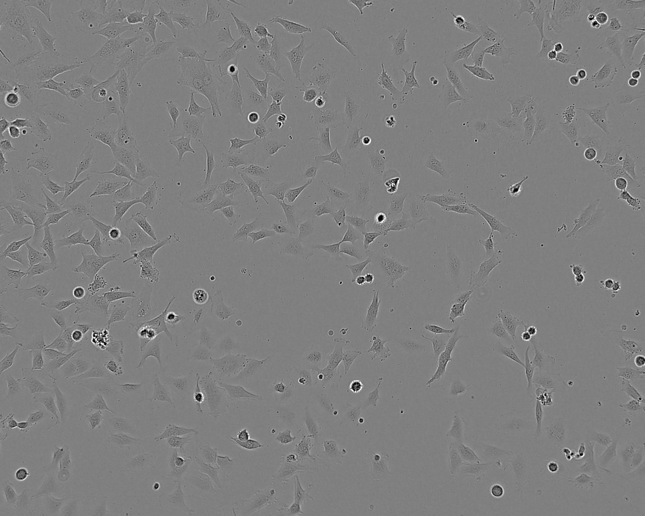 Li-7 Cell:人肝癌细胞系