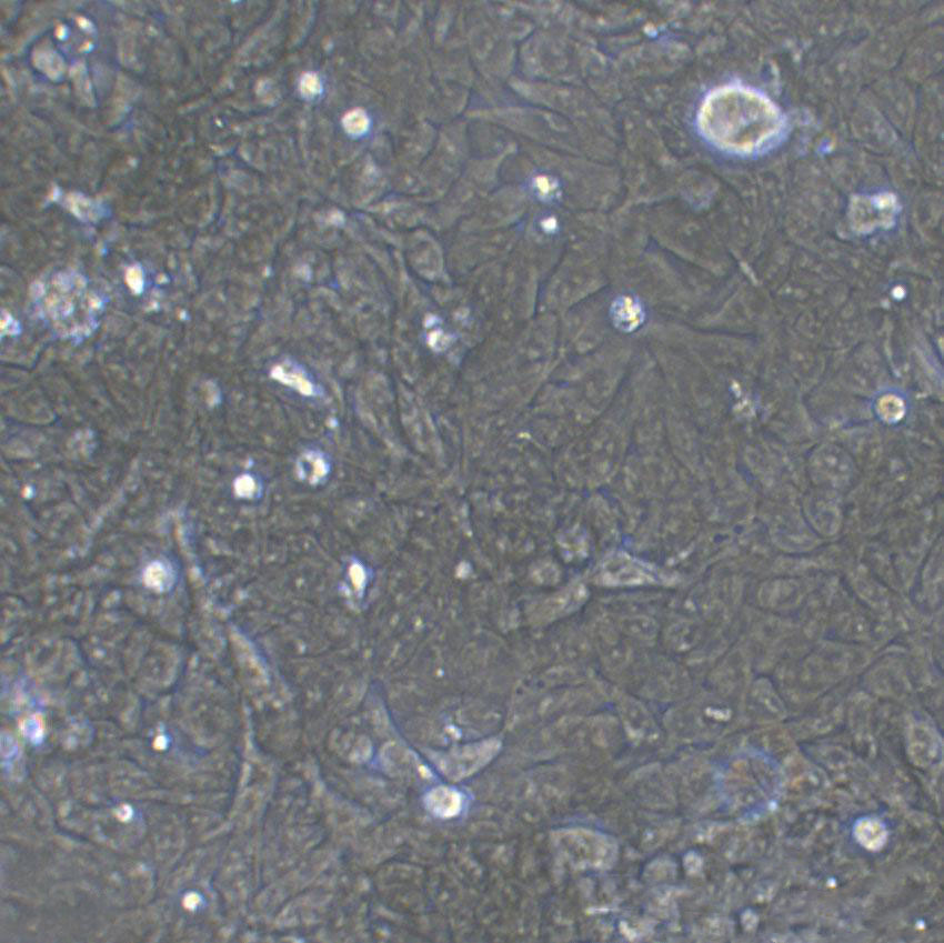 HT-3 Cell:人子宫颈癌细胞系
