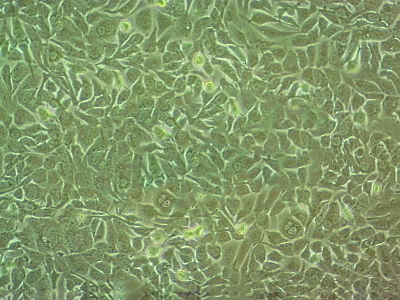 A-375 Cell:人恶性黑色素瘤细胞系