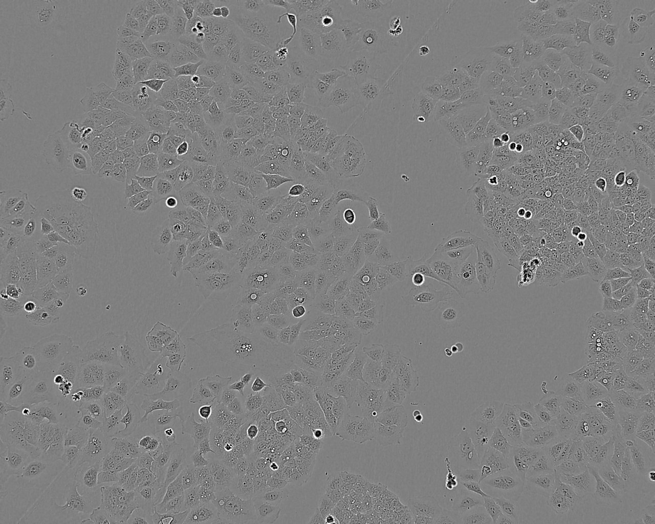 Y1 Cell:小鼠肾上腺皮质瘤细胞系