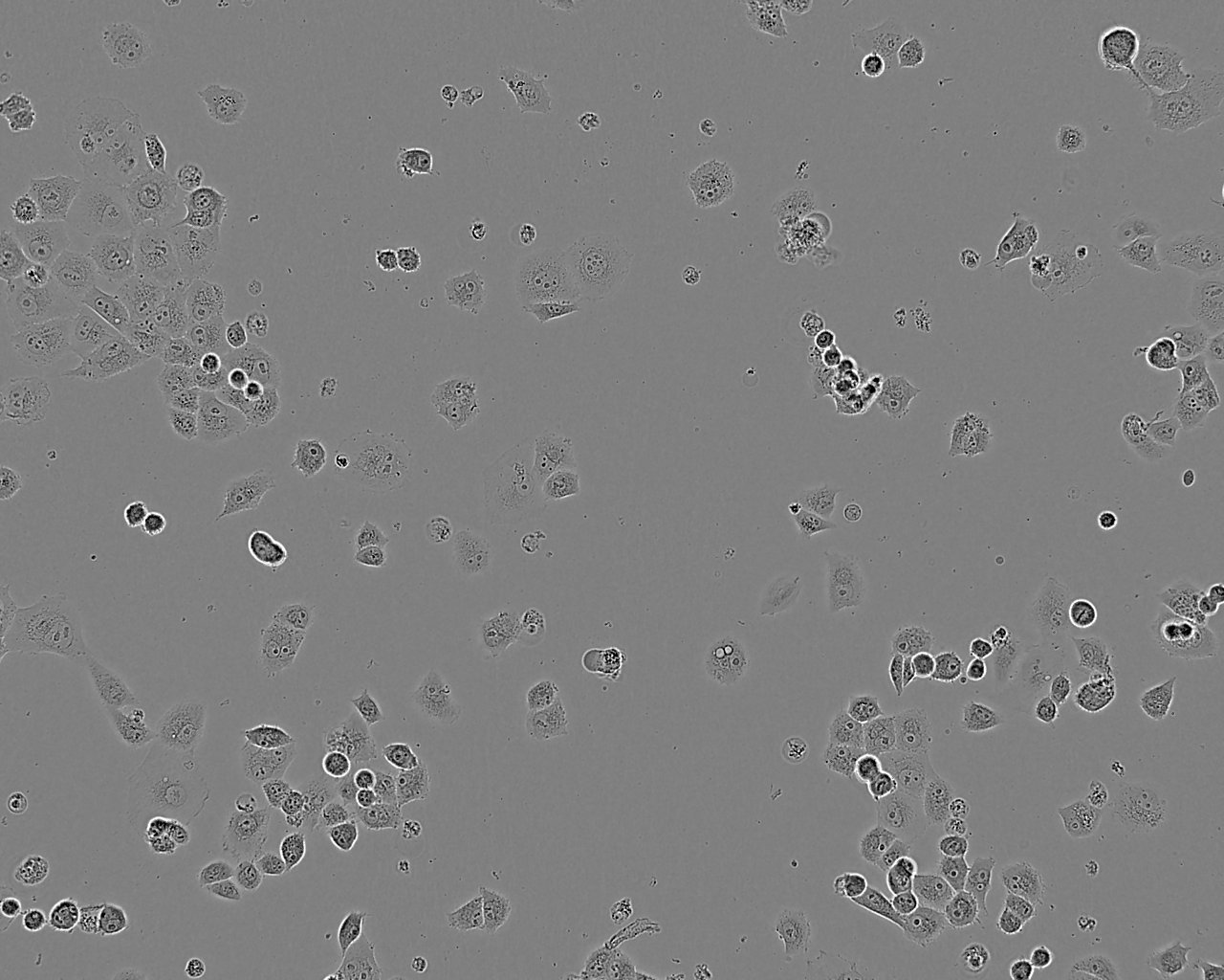 HCC1008 Cell:人乳腺导管癌细胞系