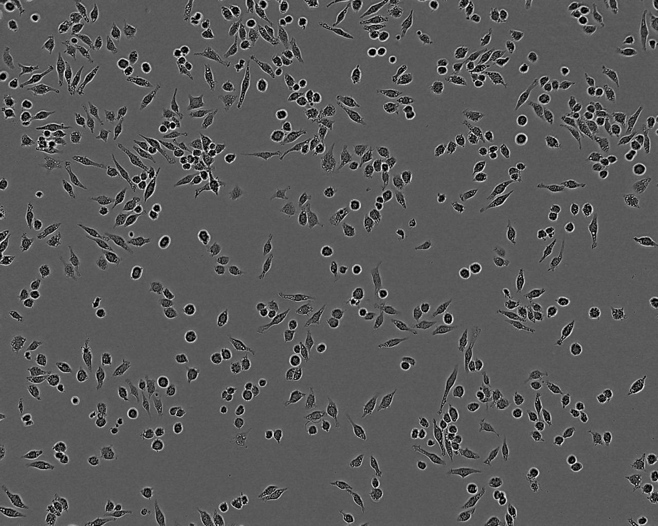 SW756 Cell:人子宫鳞状癌细胞系