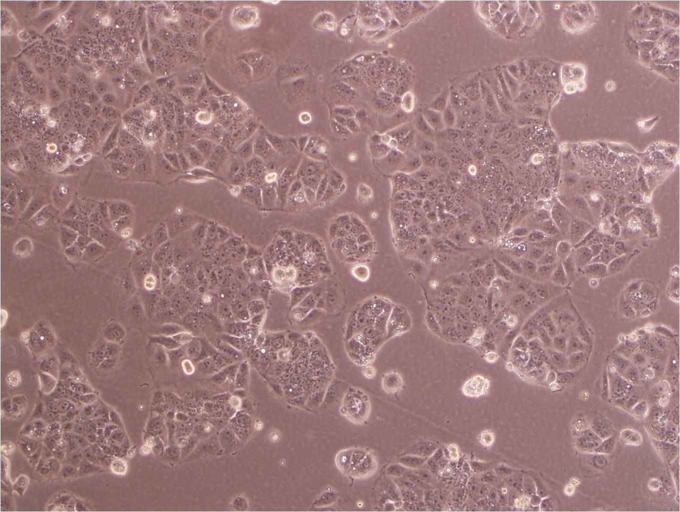 HCC-44 Cell:人肺癌细胞系