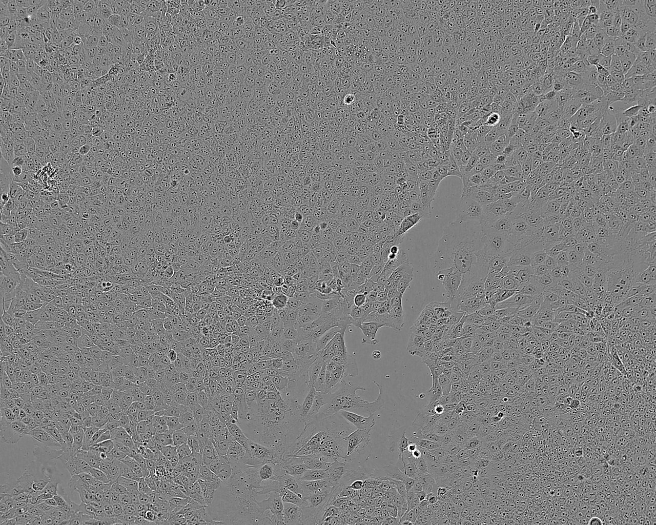 OC-3-VGH Cell:人卵巢癌细胞系