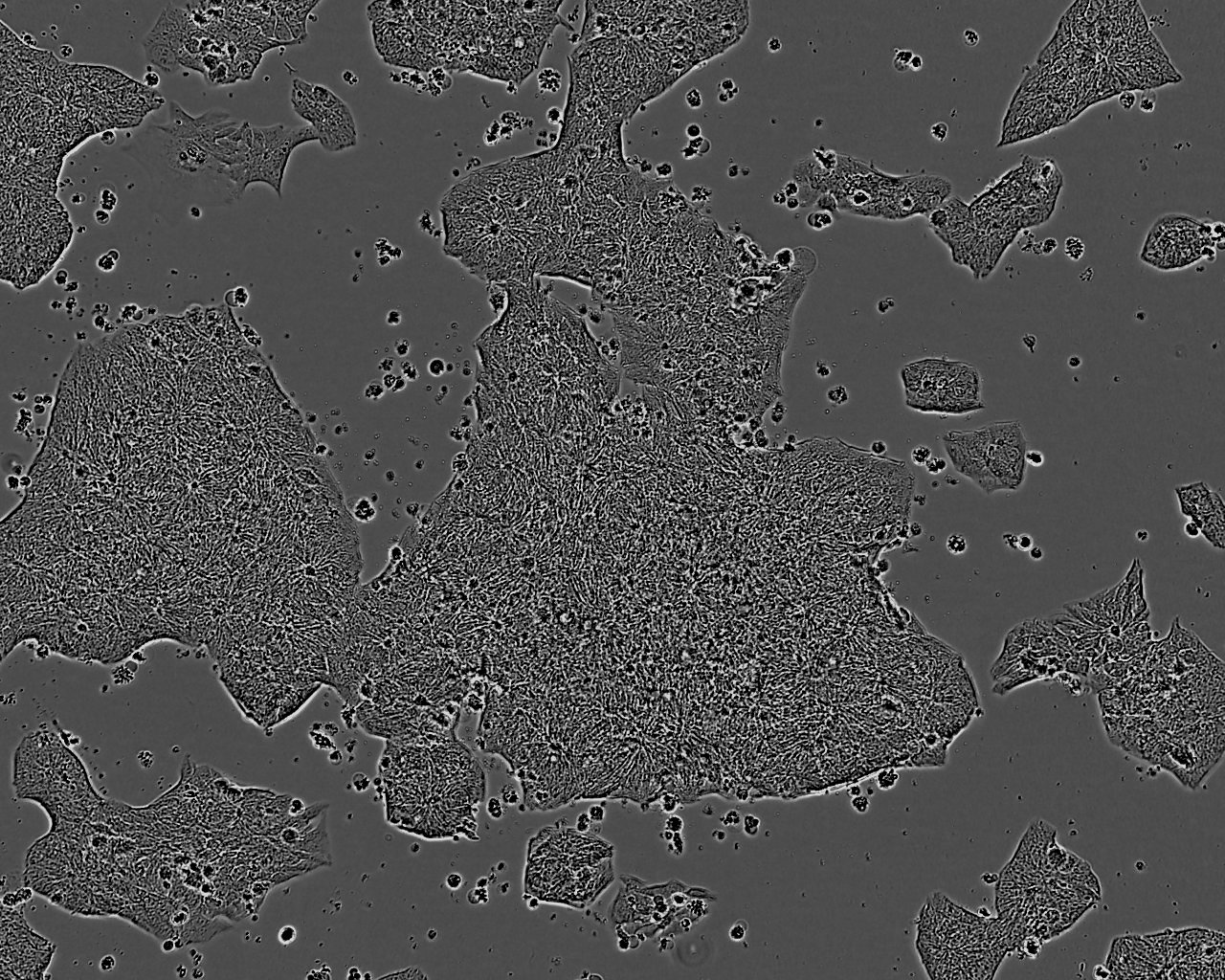 NCI-H2195 Cell:人肺癌细胞系