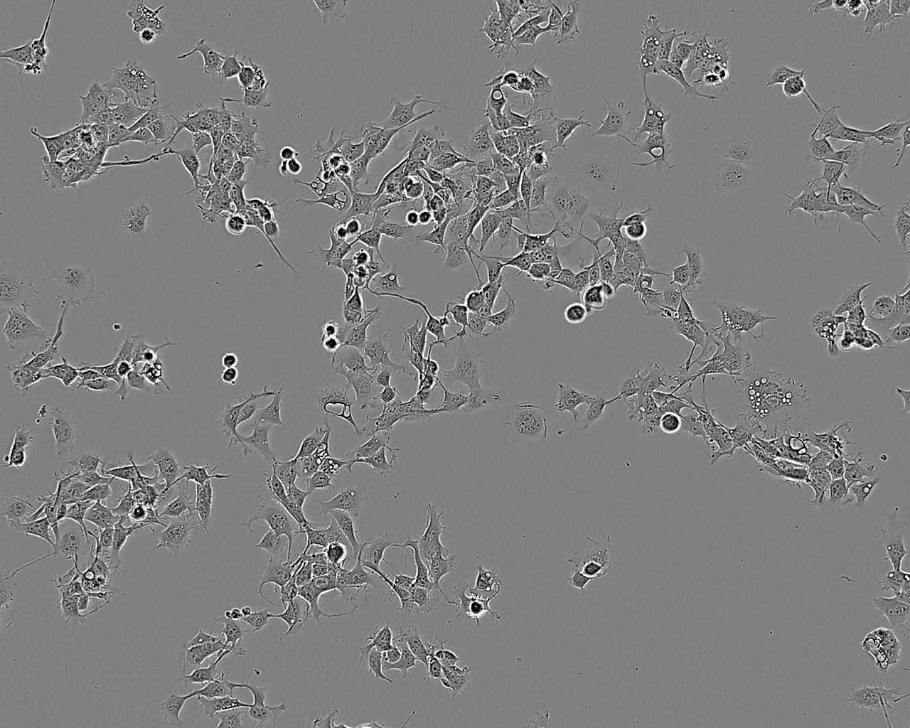 NCI-H711 Cell:人肺癌细胞系