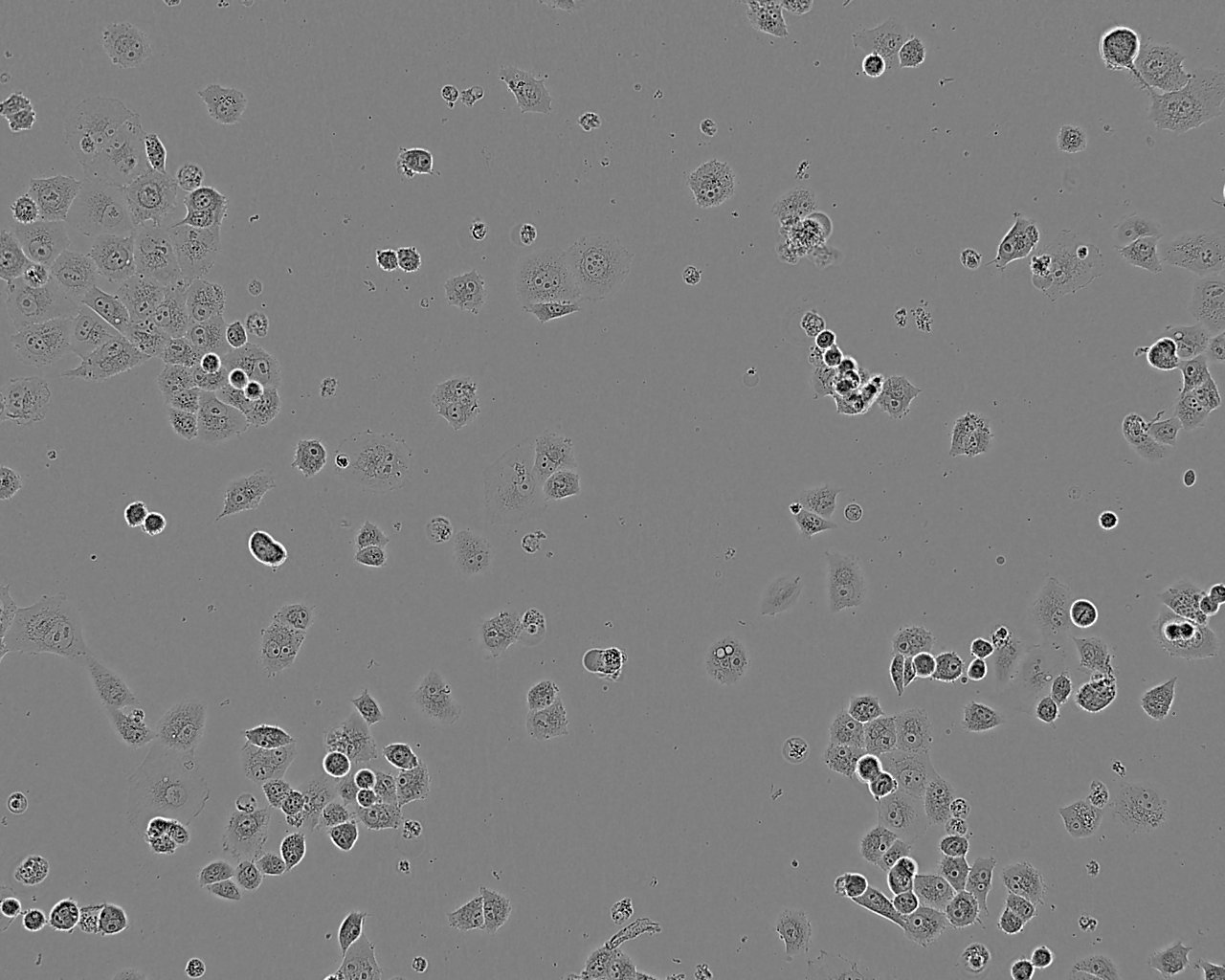RCC23 Cell:人肾透明细胞癌细胞系