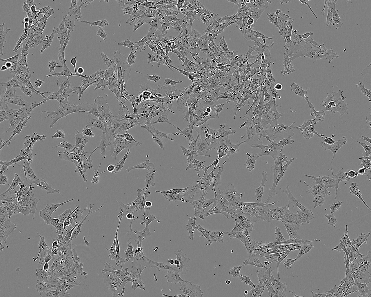 HLF Cell:人肺成纤维样细胞系