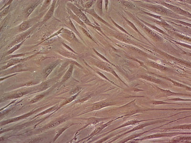 3T3-L1 Cell:小鼠前脂肪胚胎成纤维细胞系
